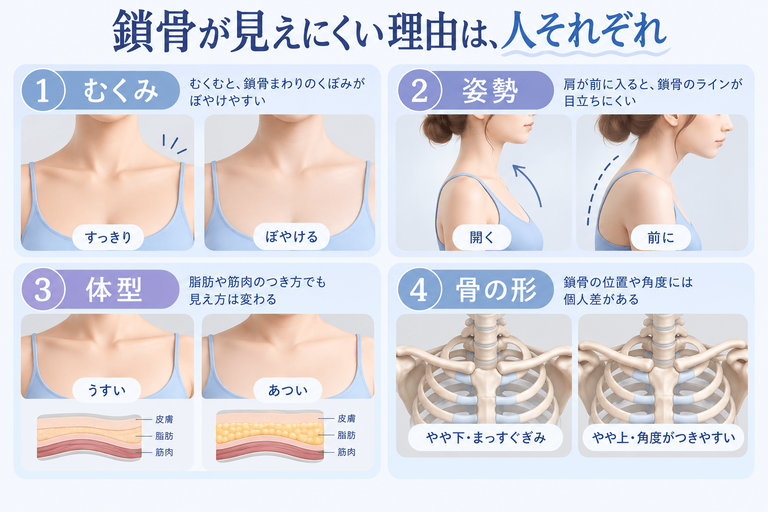 鎖骨が見えにくくなる4つの理由（むくみ・姿勢・体型・骨の形）それぞれで見え方がどう変わるかを示した解説イラスト